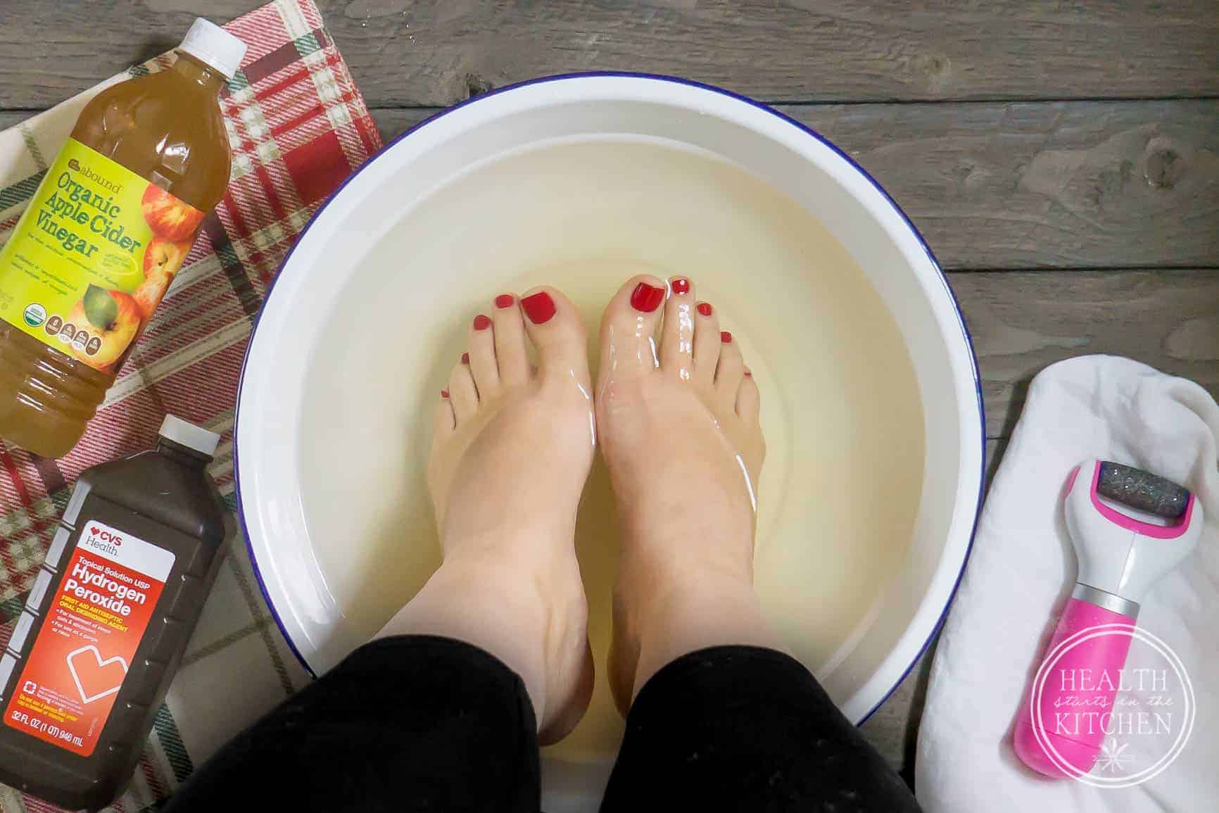 Peroxide Foot Soak for Soft Feet