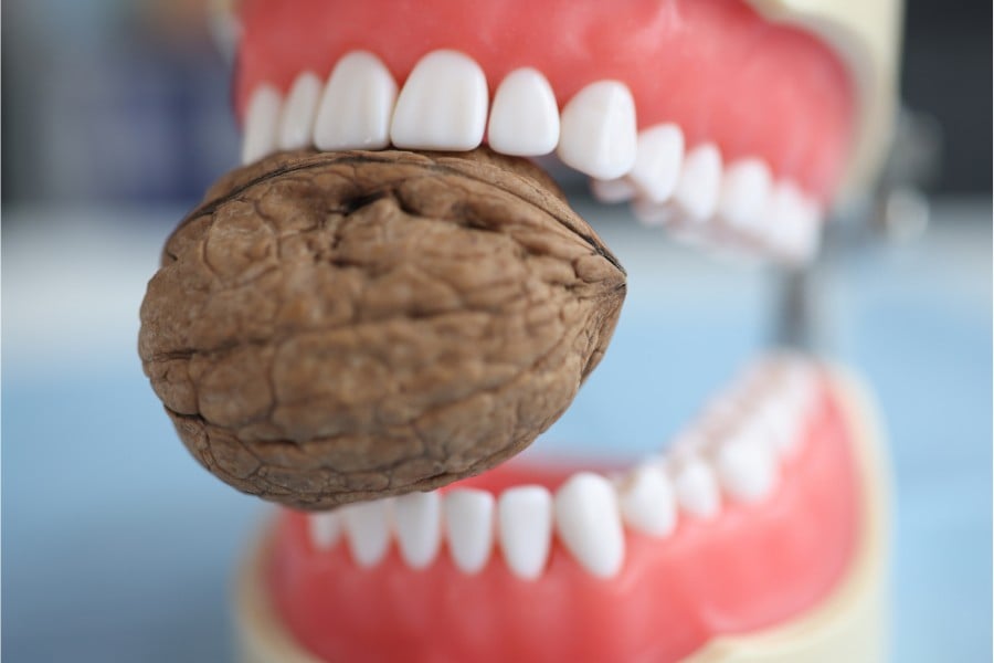 The 8 Worst Foods for Your Teeth: Best Guide for 2023 