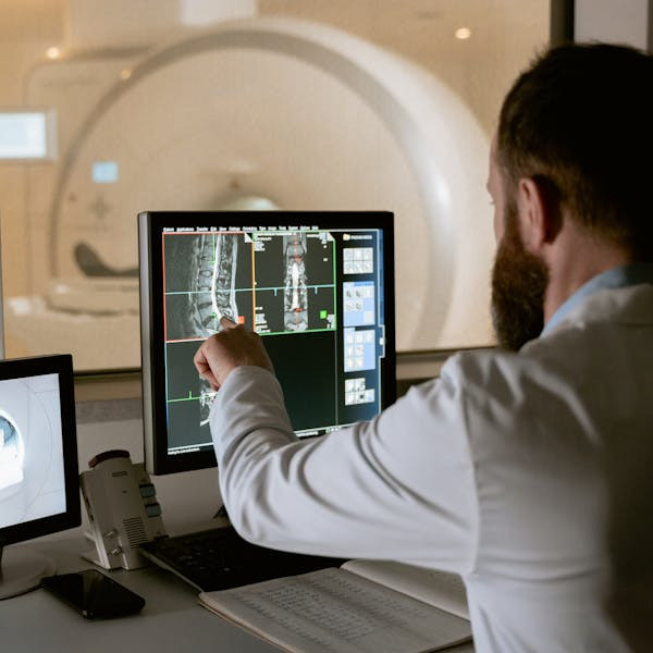 Medical professional reviewing MRI scans on computer screens for diagnostic purposes.