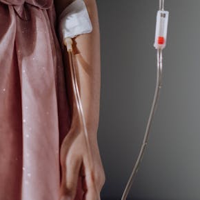 Close-up shot of a woman in a dress receiving intravenous therapy through her arm.
