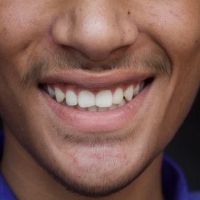 A detailed close-up of a young man's smile showcasing dental health and happiness.